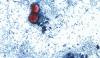 Cyclospora fears force lettuce farmers to plow fields under