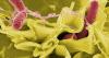 Twin Food Safety Emergencies Grip US as Egg Recall, Cyclospora Cases Rise