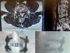 UAE performs region's first advanced spine procedure