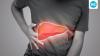 Gastroenterologist Dr Anurag Shetty shares early and advanced symptoms of liver diseases that should not be ignored