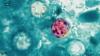 North Carolina Cyclosporiasis cases rise to 718, hospitalizations reach 24