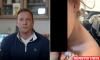 Congressman refuses to drop out of race as he denies claim he abused daughter in fumbling livestream