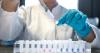 Adult epilepsy market seen hitting $17.8b by 2035 on late‑stage pipeline