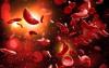 Kenya joins Africa's push to bring sickle cell care under health insurance