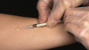 South Africa gears up for new TB vaccine