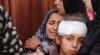 19 Palestinians Killed in Ongoing Israeli Attacks in Gaza