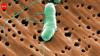 Florida's first flesh-eating bacteria death of 2026 raises concerns during beach season as warm waters fuel infections