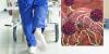 Scientists sound alarm as lethal fungal infection tearing through hospitals kills a third of patients