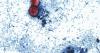 Michigan reports first U.S. deaths from multi-state cyclosporiasis outbreak