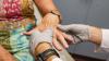 Leprosy cases reported in Ohio as Florida sees increase. Latest numbers