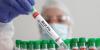 Australia confirms first mass death of seabirds linked to H5N1 bird flu