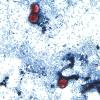 Michigan health officials report two deaths, parasite cases topping 11,000