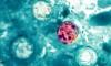 First deaths from parasite that causes 'explosive' symptoms reported in Michigan... as cases in the state top 11,000