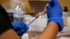Arizona reports first-ever case of more serious form of mpox