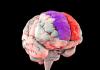 Your brain changes shape as its overall health improves