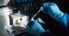 Australia launches $5.9m brain cancer grants