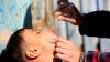 WHO: Afghanistan reports 15 polio cases in 2026