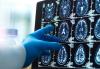 Scientists Find Hidden Alzheimer’s Brain Buildups That May Appear Early