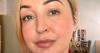 'I forgot five years of my life including Fiji wedding trip after contraception caused brain tumour'