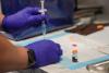 Texas doctors urge parents to update children’s MMR vaccines as measles outbreak grows
