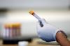 A new test could detect Alzheimer’s within minutes. Should I have one?