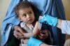Afghan child malnutrition surges as aid cuts force clinics to turn families away: WFP