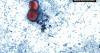 Health Beat: First U.S. deaths confirmed in Cyclospora outbreak