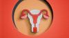 Childhood Adversity Shapes Reproductive Health in Women