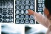 UP researchers unlock new way to monitor brain diseases