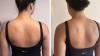 KP and stretch mark-sufferers see 'great results on dry bumpy legs' with £15 wipes