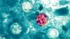 'Sharp rise' in cyclosporiasis cases in UK linked to Mexico travel. What to know