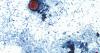 Almost 1K people sickened by cyclospora in Illinois, 3 times more than last year