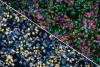 “Cell Village” Platform Uncovers Genetic Drivers of Brain Growth