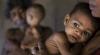 Child Malnutrition Crisis Reaches Critical Levels in Afghanistan