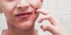 Early Childhood Infections Tied to Higher Risk for Atopic Dermatitis