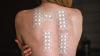 Patch Test Allergen Results Differ by Race and Ethnicity