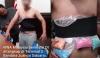 [Watch] KLIA Again: Malaysian Caught In Surabaya With Drugs Strapped To His Body Under A Corset