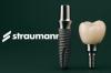 Dental implants in Cuenca: What every expat should know before choosing a dental clinic