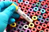 Self-Collected HPV Tests Detected Precancerous Cervical Changes with High Accuracy in a New Review