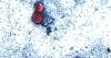Ohio cyclosporiasis cases top 4,000 as health officials urge caution with produce