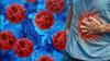 Cyclosporiasis cases in Michigan climb to over 12,000