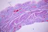 Scientists find new evidence that microplastics can cross into the placenta, disrupt pregnancy hormones