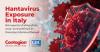 <![CDATA[Serologic Study Finds Hantavirus Exposure in Northwestern Italy]]>