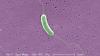 What to Know About the ‘Flesh-Eating’ Bacteria That Killed Someone in Florida