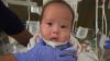 Oklahoma baby who has never been home undergoes rare treatment in Boston