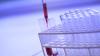 Basque Country halves colon cancer deaths with screening programme