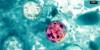 Cyclosporiasis cases spike in Kansas