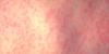 Wayne County Health Department confirms 2 measles cases