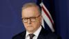 Albanese’s winter of discontent deepens as housing, immigration chaos consumes his cabinet
