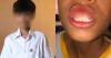 Mum seeks answers after alleged school assault leaves son, 14, with fractured jaw, broken tooth: 'It broke my heart'